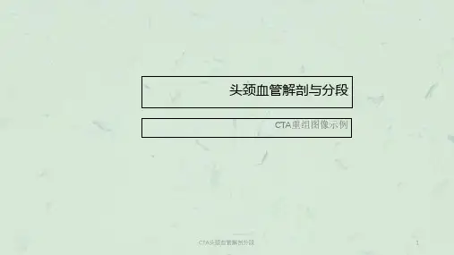 CTA头颈血管解剖分段课件