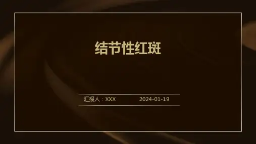 结节性红斑演示课件
