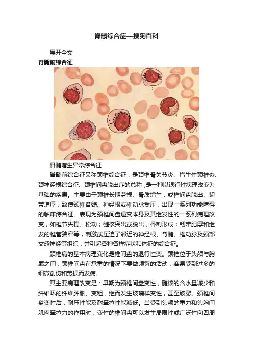 脊髓综合症—搜狗百科