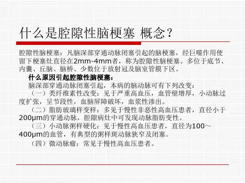 腔隙性脑梗塞详细介绍
