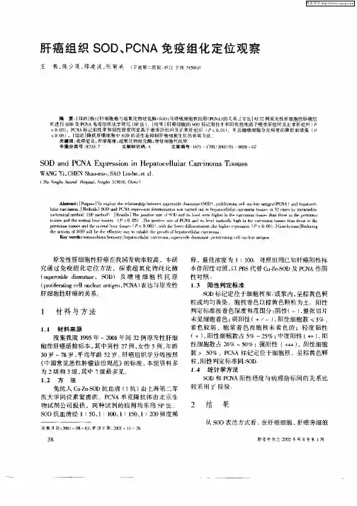 肝癌组织SOD、PCNA免疫组化定位观察