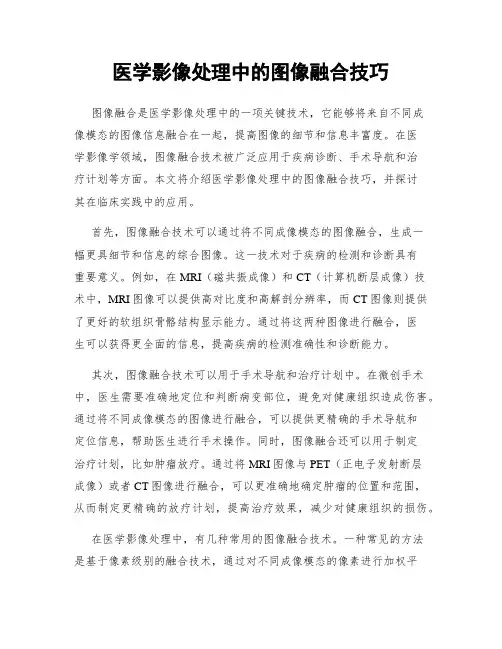 医学影像处理中的图像融合技巧