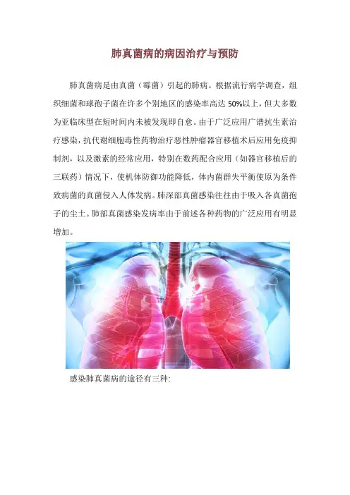 肺真菌病的病因治疗与预防