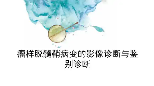 瘤样脱髓鞘病变的影像诊断与鉴别诊断