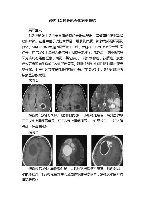颅内12种环形强化病变总结