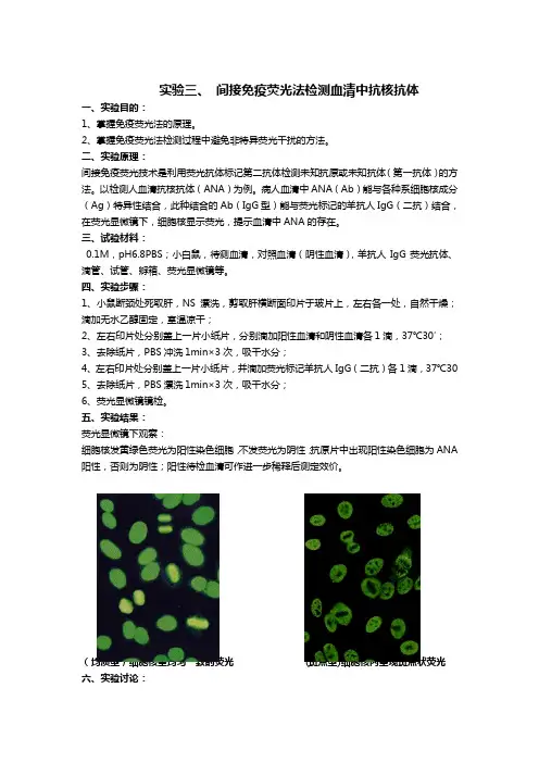 临床免疫实验 间接免疫荧光法测抗核抗体实验报告