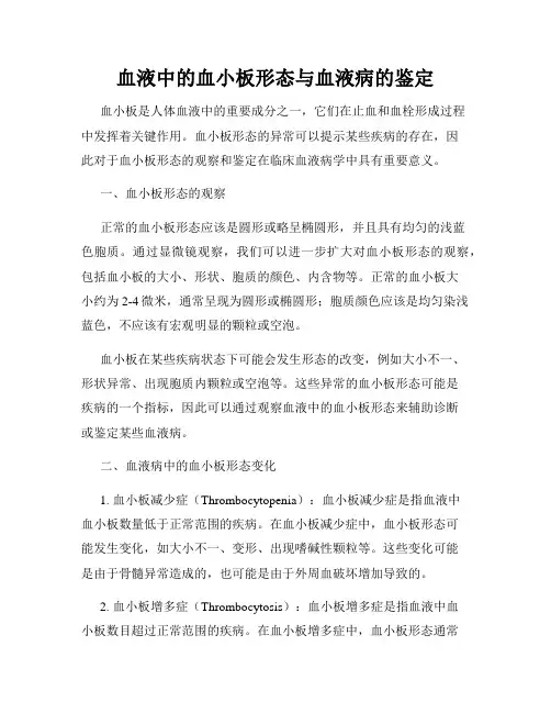 血液中的血小板形态与血液病的鉴定