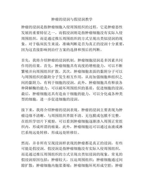 肿瘤的浸润与假浸润教学 