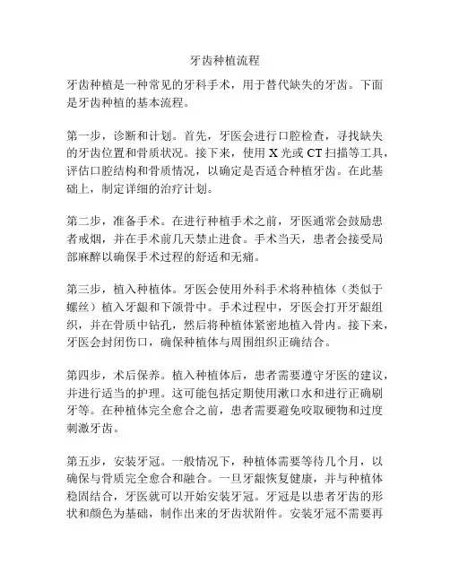 牙齿种植流程