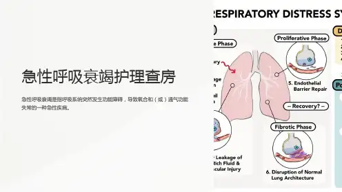 急性呼吸衰竭护理查房