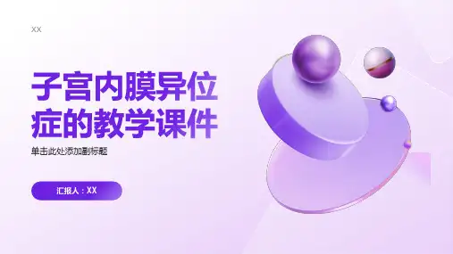 子宫内膜异位症的教学课件