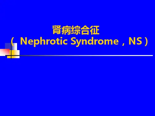 肾病综合征
