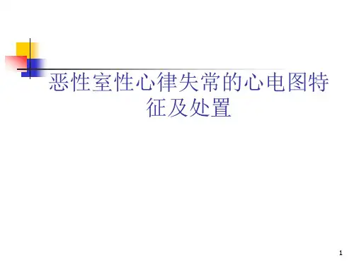 恶性室性心律失常的心电图特征与处置ppt课件