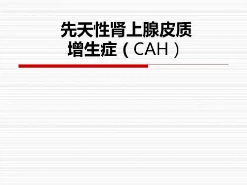 先天性肾上腺皮质增生症PPT课件