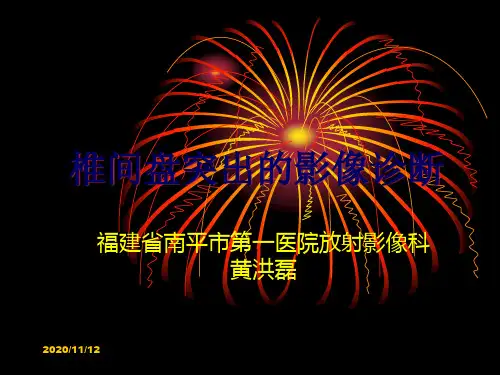 椎间盘脱出的影像诊断