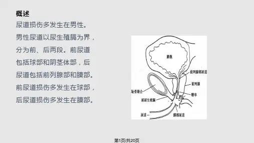 尿道损伤的治疗与护理PPT课件