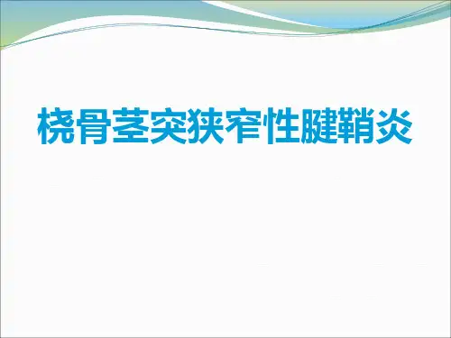 桡骨茎突狭窄性腱鞘炎