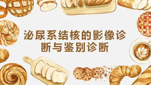 泌尿系结核 的影像诊断