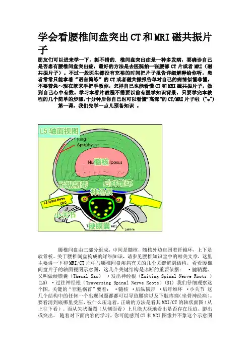 腰椎图片