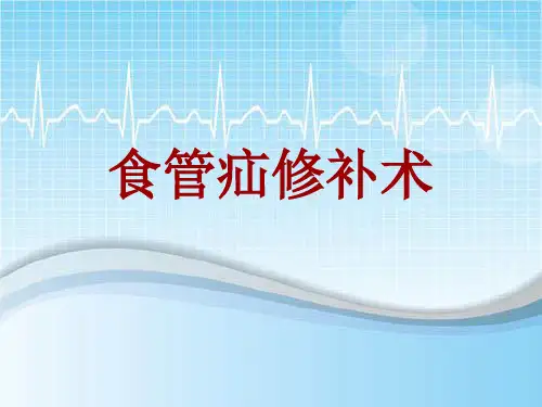 手术讲解模板：食管疝修补术