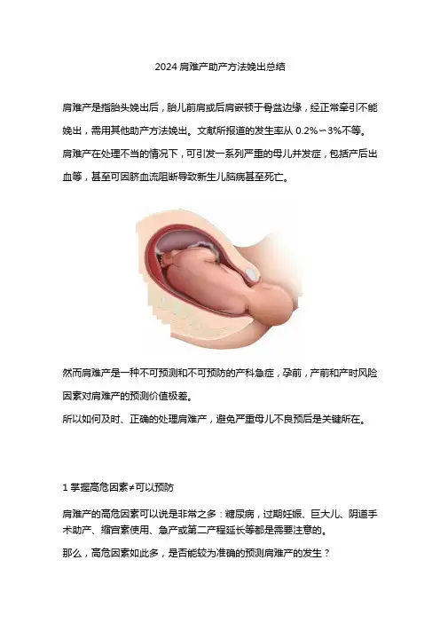 2024肩难产助产方法娩出总结