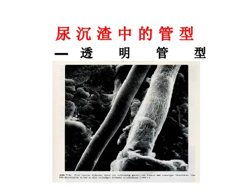 尿沉渣各种管型