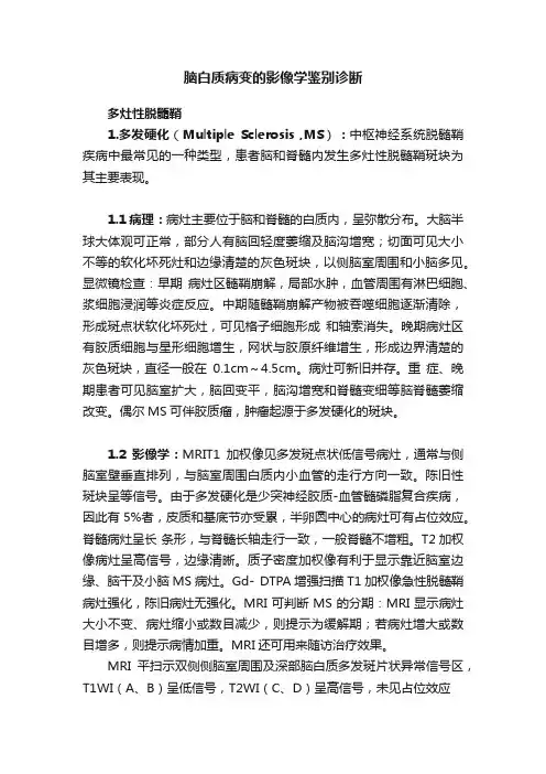 脑白质病变的影像学鉴别诊断