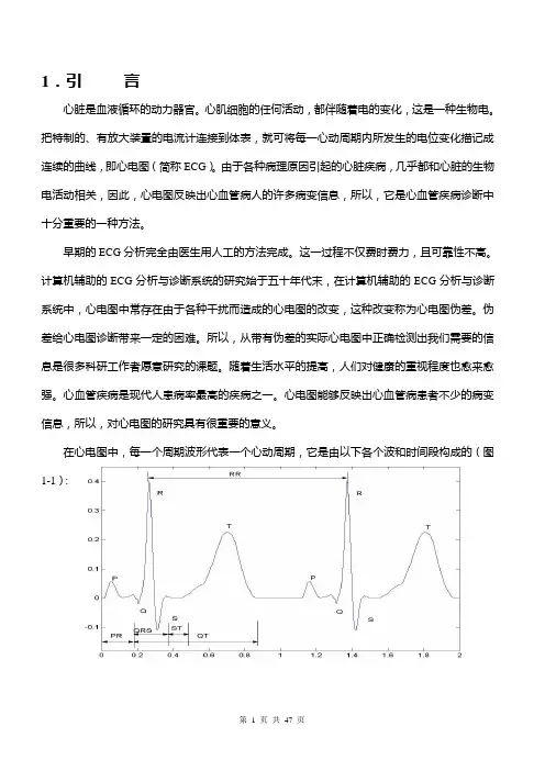 ECG(心电图)