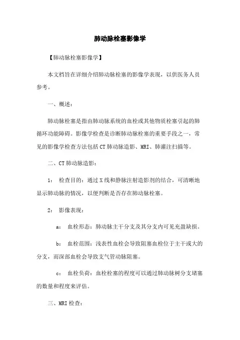 肺动脉栓塞影像学