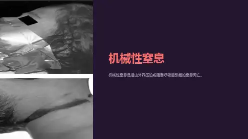 法医学课件)05机械性窒息