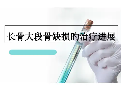 长骨大段骨缺损诊疗进展