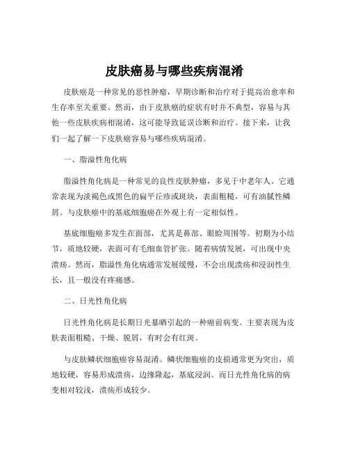皮肤癌易与哪些疾病混淆