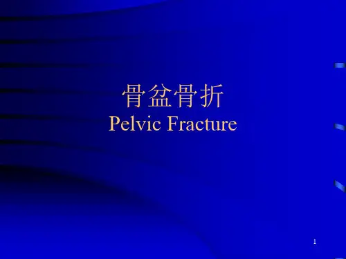 骨盆骨折的分型与治疗PPT课件