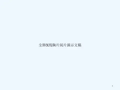 尘肺X线胸片阅片演示文稿课件