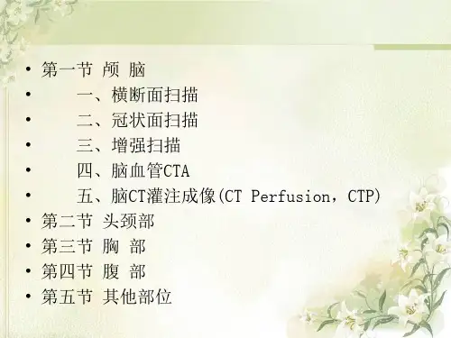 脑CT灌注成像