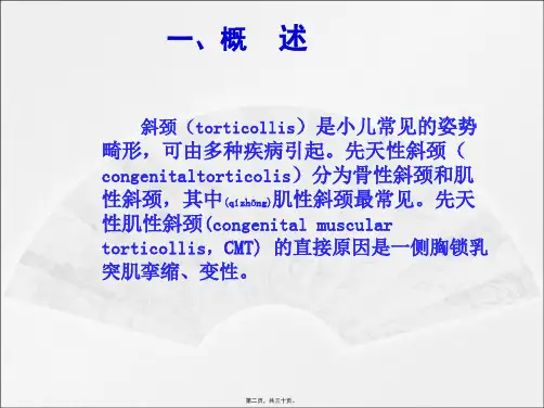 医学专题先天性肌性斜颈的康复