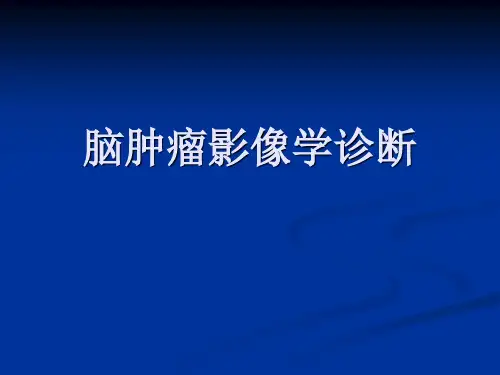 脑肿瘤影像学诊断精品医学PPT课件