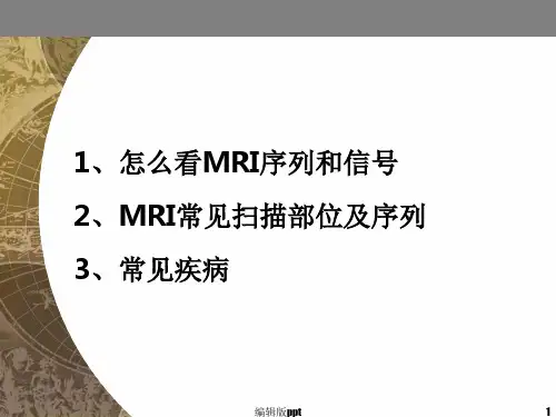 手把手教你看MRI片PPT课件