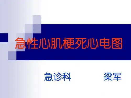 急性心肌梗死的心电图诊断