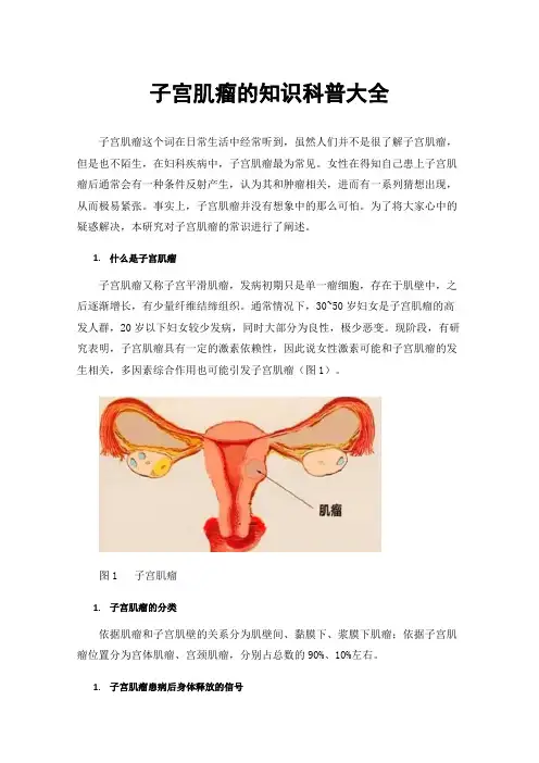 子宫肌瘤的知识科普大全