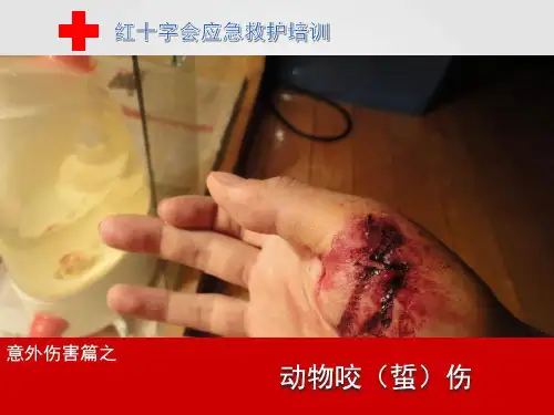 动物咬(蛰)伤-红十字应急救护培训课件