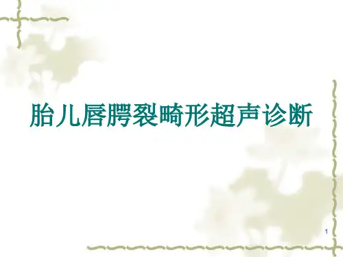 唇腭裂ppt课件
