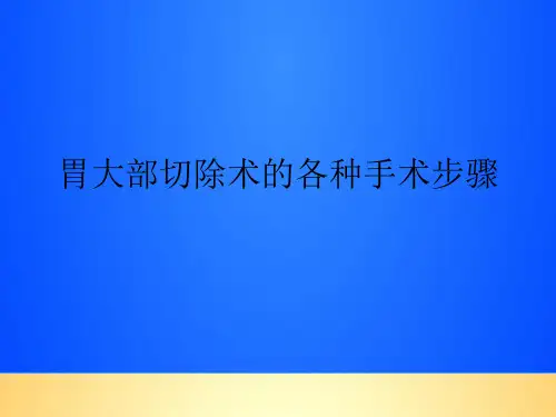 【优质】胃大部切除术的各种手术步骤PPT文档