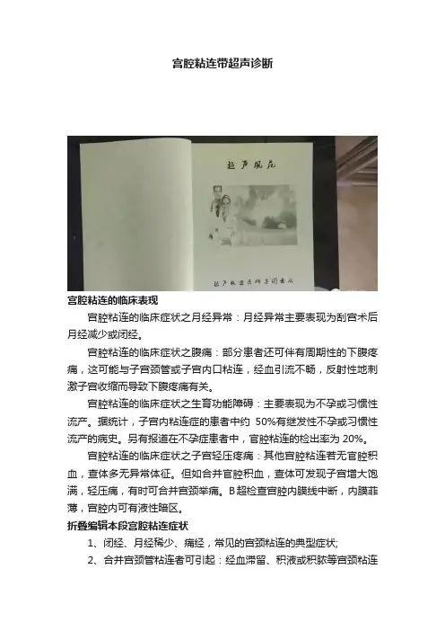 宫腔粘连带超声诊断
