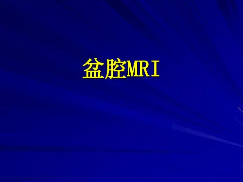 盆腔MRI