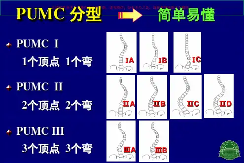 特发性脊柱侧凸PUMC分型系统培训课件