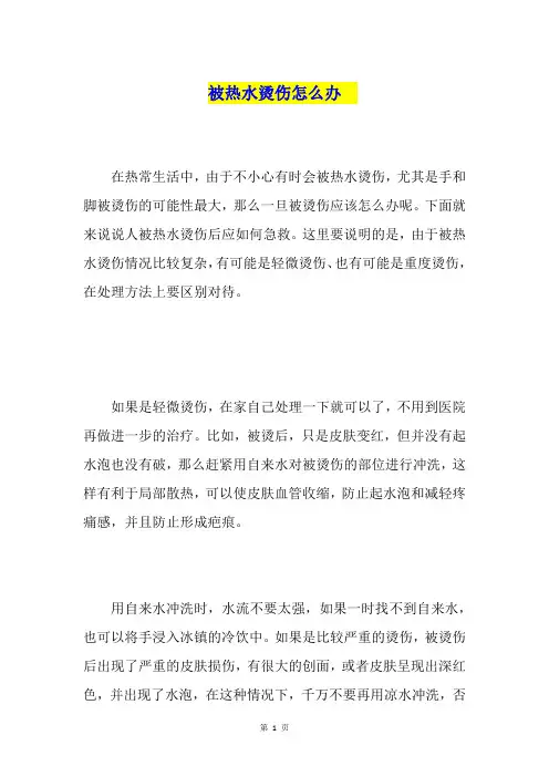 被热水烫伤怎么办