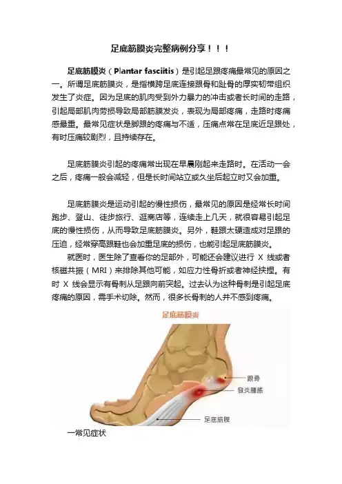 足底筋膜炎完整病例分享！！！
