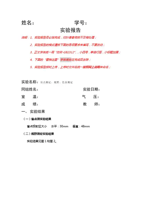 盲点、视野测定
