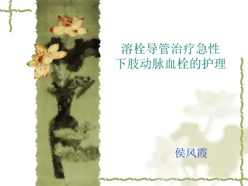 导管溶栓 PPT课件 